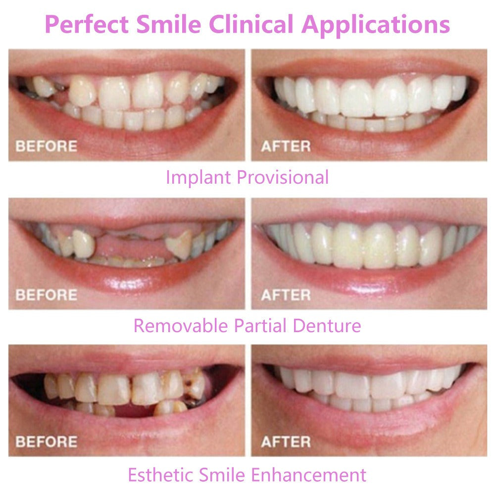 Simulation Braces